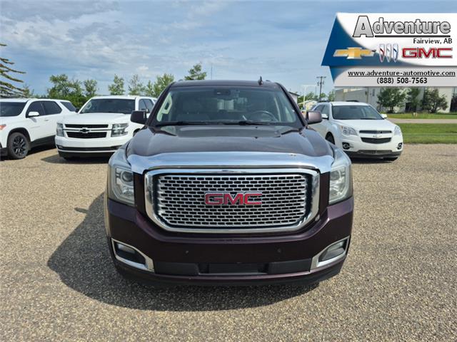 2017 GMC Yukon Denali (Stk: 45111A) in Fairview - Image 16 of 30