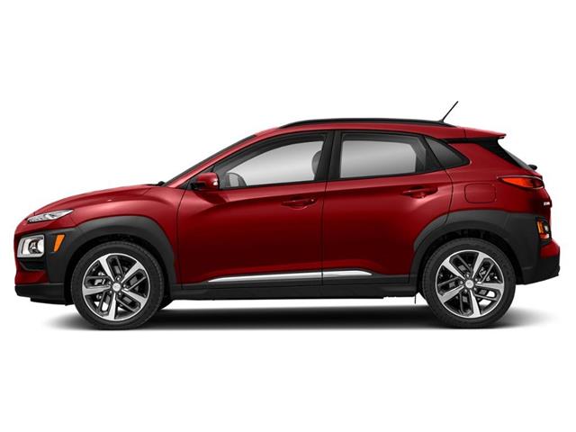 2019 Hyundai Kona 1.6T Ultimate (Stk: 2106486A) in Whitby - Image 2 of 12