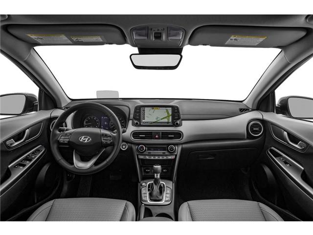 2019 Hyundai Kona 1.6T Ultimate (Stk: 2106486A) in Whitby - Image 5 of 12