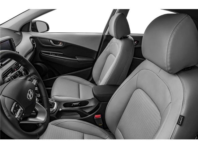 2019 Hyundai Kona 1.6T Ultimate (Stk: 2106486A) in Whitby - Image 6 of 12