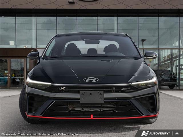 2025 Hyundai Elantra N Base (Stk: U25E160A) in London - Image 2 of 27