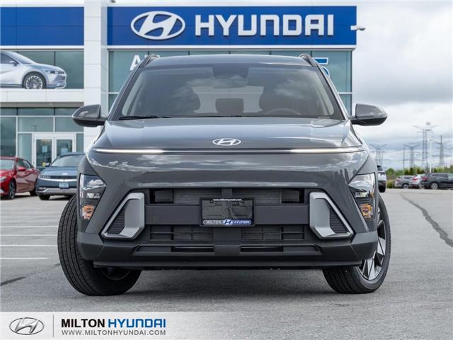 2026 Hyundai Kona 2.0L Preferred (Stk: 477740) in Milton - Image 2 of 22 2026 Hyundai Kona 2.0L Preferred (Stk: 477740) in Milton - Image 2 of 22