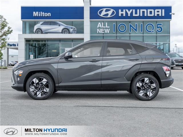 2026 Hyundai Kona 2.0L Preferred (Stk: 477740) in Milton - Image 3 of 22 2026 Hyundai Kona 2.0L Preferred (Stk: 477740) in Milton - Image 3 of 22