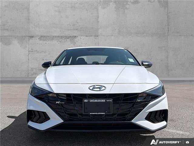 2021 Hyundai Elantra N Line (Stk: C109150) in Richmond - Image 2 of 25