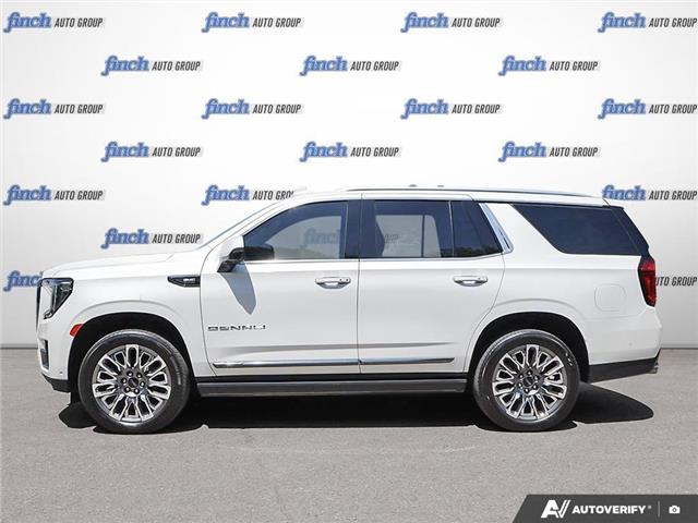 2023 GMC Yukon Denali Ultimate (Stk: 176080) in London - Image 3 of 27