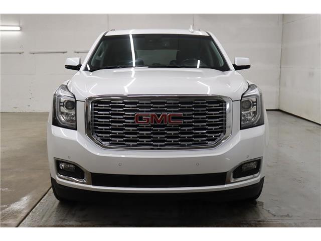 2018 GMC Yukon Denali (Stk: T3511A) in Watrous - Image 4 of 39