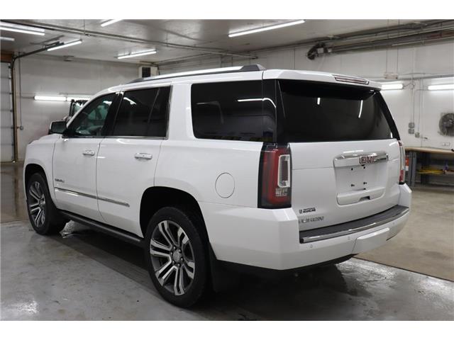 2018 GMC Yukon Denali (Stk: T3511A) in Watrous - Image 5 of 39