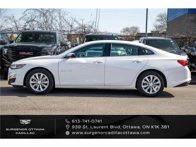 2025 Chevrolet Malibu 1LT (Stk: 26054A) in Ottawa - Image 7 of 20 2025 Chevrolet Malibu 1LT (Stk: 26054A) in Ottawa - Image 7 of 20