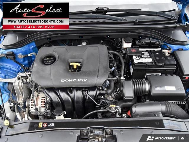 2017 Hyundai Elantra Limited (Stk: 1TBE187) in Scarborough - Image 8 of 28