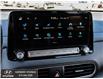 2020 Hyundai Kona Electric Ultimate (Stk: P1075A) in Rockland - Image 6 of 31