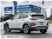2020 Hyundai Kona 1.6T Ultimate (Stk: 483563) in Milton - Image 5 of 25