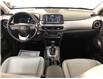 2018 Hyundai Kona 1.6T Ultimate (Stk: 39486J) in Belleville - Image 21 of 31
