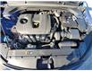 2020 Hyundai Elantra Luxury (Stk: S1100) in Welland - Image 28 of 28