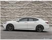 2020 Acura TLX  (Stk: 16250C) in Hamilton - Image 3 of 27