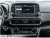 2020 Hyundai Kona 1.6T Ultimate (Stk: 495658) in Milton - Image 25 of 25