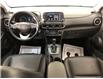 2020 Hyundai Kona 2.0L Luxury (Stk: 39725J) in Belleville - Image 19 of 26