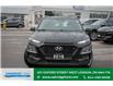 2018 Hyundai Kona 2.0L Essential (Stk: Z51892A) in London - Image 2 of 20