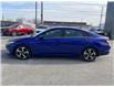2021 Hyundai Elantra  (Stk: UM3069) in Chatham - Image 9 of 26