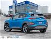 2020 Hyundai Kona 1.6T Ultimate (Stk: 437402) in Milton - Image 5 of 26