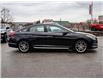 2017 Hyundai Sonata 2.0T Sport Ultimate (Stk: U1557) in Lindsay - Image 3 of 29