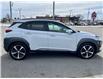 2018 Hyundai Kona 1.6T Ultimate (Stk: 23223A) in Temiskaming Shores - Image 8 of 17