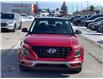 2022 Hyundai Venue  (Stk: 32400A) in Gatineau - Image 2 of 18