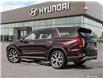 2020 Hyundai Palisade  (Stk: 90378) in London - Image 4 of 26