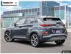 2020 Hyundai Kona 1.6T Ultimate (Stk: 17957AA) in Oakville - Image 4 of 27