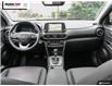 2020 Hyundai Kona 1.6T Ultimate (Stk: 17957AA) in Oakville - Image 25 of 27