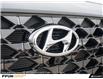 2023 Hyundai Santa Fe Ultimate Calligraphy (Stk: 70194) in Saskatoon - Image 9 of 23