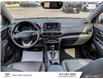 2021 Hyundai Kona 1.6T Ultimate w/Red Colour Pack (Stk: 23265B) in Smiths Falls - Image 27 of 28