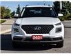 2021 Hyundai Venue Ultimate w/Black Interior (IVT) (Stk: 23337A) in Barrie - Image 3 of 28