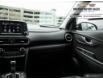 2020 Hyundai Kona 2.0L Luxury (Stk: 144543A) in Oshawa - Image 32 of 36