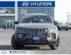 2024 Hyundai Santa Cruz Ultimate (Stk: 100130) in Milton - Image 2 of 32