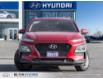 2019 Hyundai Kona 2.0L Essential (Stk: 215018) in Milton - Image 2 of 23