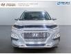 2021 Hyundai Kona 1.6T Trend (Stk: 240674NA) in Grand Falls - Image 2 of 15