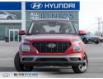 2022 Hyundai Venue Trend (Stk: 167509) in Milton - Image 2 of 23