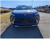 2024 Buick Envision Avenir (Stk: 241090) in Haliburton - Image 2 of 20