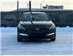 2017 Hyundai Sonata  (Stk: KG60453) in Edmonton - Image 3 of 10