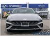 2025 Hyundai Elantra Luxury IVT (Stk: 915856) in Whitby - Image 6 of 20