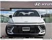 2025 Hyundai Sonata N-Line Ultimate (Stk: A458851) in Brooklin - Image 2 of 25
