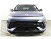2025 Hyundai Kona 1.6T N Line w/Two-Tone Roof (Stk: 16103636) in Markham - Image 2 of 24