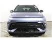 2025 Hyundai Kona 1.6T N Line Ultimate w/Two-Tone Roof (Stk: 16104056) in Markham - Image 2 of 24