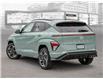 2025 Hyundai Kona 1.6T N Line Ultimate (Stk: 25597) in Toronto - Image 4 of 20