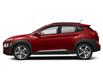 2021 Hyundai Kona 1.6T Ultimate w/Red Colour Pack (Stk: H04564) in Prince Albert - Image 2 of 12