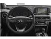 2021 Hyundai Kona 1.6T Ultimate w/Red Colour Pack (Stk: H04564) in Prince Albert - Image 4 of 12