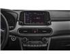 2021 Hyundai Kona 1.6T Ultimate w/Red Colour Pack (Stk: H04564) in Prince Albert - Image 7 of 12