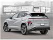 2025 Hyundai Kona 1.6T N Line Ultimate (Stk: 25602) in Toronto - Image 4 of 22