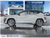 2025 Hyundai Kona 1.6T N Line w/Two-Tone Roof (Stk: 295715) in Milton - Image 3 of 24