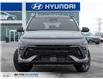 2025 Hyundai Kona 1.6T N Line Ultimate (Stk: 271022) in Milton - Image 2 of 33